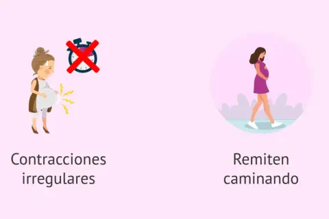 Contracciones irregulares y que remiten caminando son síntomas de parto.