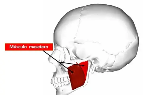 Dolor de masetero: Alivia la tensión mandibular y el bruxismo