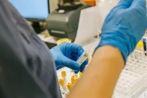 Laborant hanterar provrör i laboratoriemiljö, en del av forskningen kring anhedoni behandling.