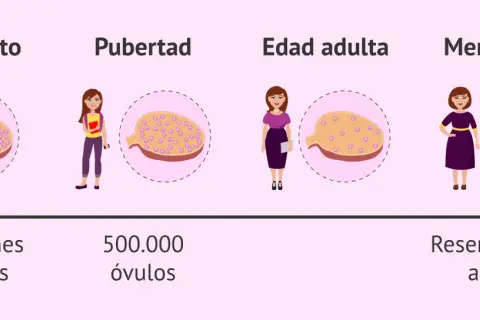 Ilustración muestra la disminución de la reserva ovárica desde el nacimiento hasta la menopausia, con un ovario que contiene menos óvulos en cada etapa.