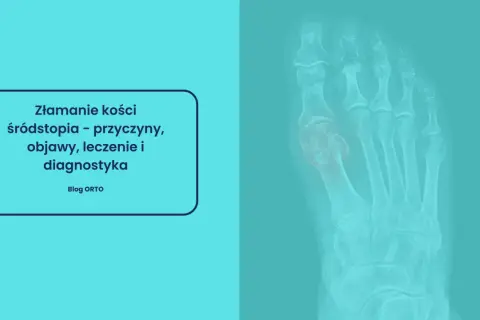 Rentgen stopy z widocznym złamaniem kości śródstopia.