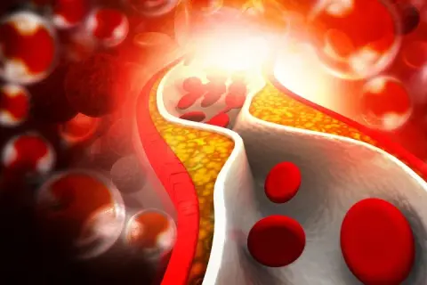 Czy omega 3 obniża cholesterol? Sprawdź, jak wpływa na LDL i HDL