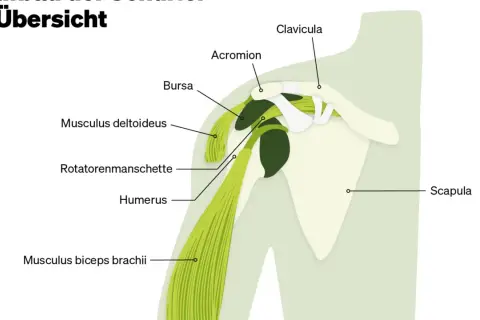 Anatomische Übersicht der Schulter mit Muskeln, Knochen und Bursa. Hilfreich bei **Verspannung Schulter**.
