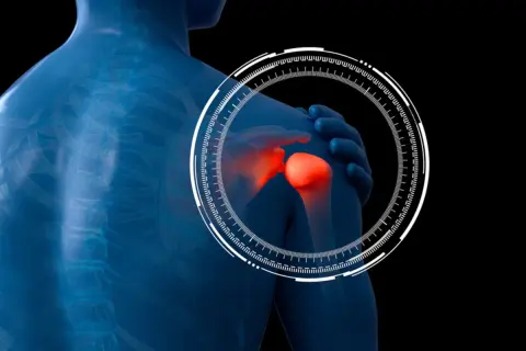 Focus su esercizi per artrosi spalla: immagine 3D di spalla infiammata, con cerchio tecnologico.