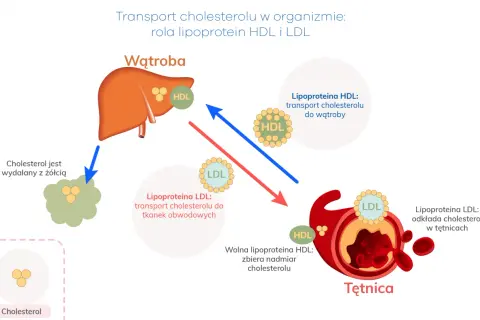 Ilustracja pokazuje transport cholesterolu, wyjaśniając, co to jest dyslipidemia. HDL transportuje cholesterol do wątroby, a LDL do tkanek, odkładając go w tętnicach.