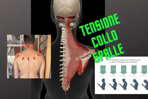 Anatomia muscolare e scheletrica del collo e delle spalle, con frecce rosse che indicano punti di dolore e un grafico sulla tensione muscolare collo.