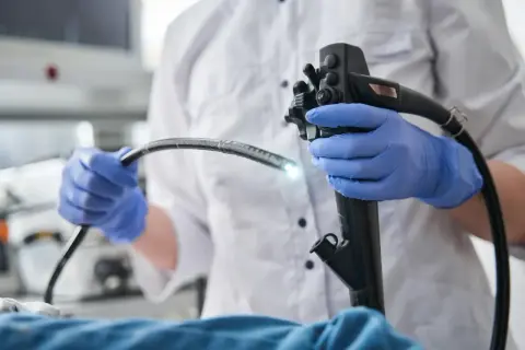 Lekarz w niebieskich rękawiczkach trzyma gastroskop. Badanie gastroskopia NFZ pozwala na diagnostykę.