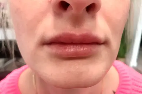 Czy makijaż permanentny ust boli? Poznaj prawdę o bólu i znieczuleniu