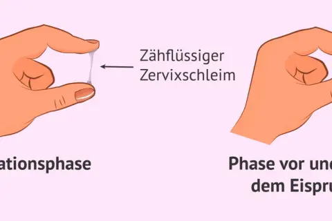 Hände zeigen Zervixschleim: zähflüssig in der Ovulationsphase, klumpig davor/danach. Ein Zeichen für Fruchtbarkeit bei Frauen.