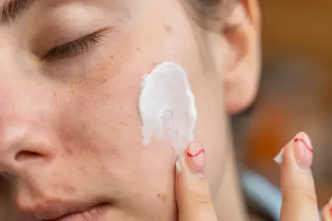 Kwas azelainowy i retinol to składniki aktywne w pielęgnacji skóry. Krem nakładany na twarz, widoczne piegi i zaczerwienienia.