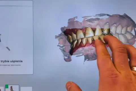 Co dentysta widzi? Więcej niż myślisz - poznaj prawdę