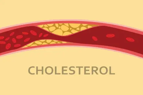 Czy cholesterol jest produkowany w skórze? Odkryj jego znaczenie dla zdrowia