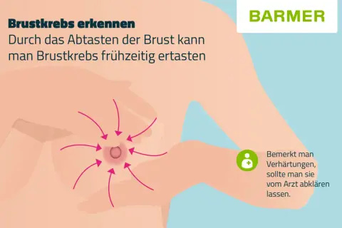 Brustkrebs erkennen: Pfeile zeigen auf eine Brustwarze, wo sich Knoten in der Brust befinden könnten. Bei Verhärtungen Arzt aufsuchen.