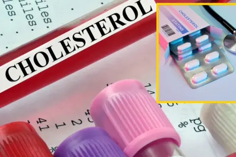 Czy leki na cholesterol odchudzają? Sprawdź, co mówią badania