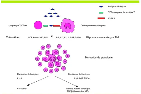 Schéma illustrant la formation de granulomes, un symptôme de la sarcoïdose, impliquant des lymphocytes T et des cellules présentant l'antigène.