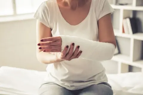 Kobieta z ręką w gipsie na złamania. Biały opatrunek obejmuje przedramię i dłoń, zapewniając stabilizację po urazie.