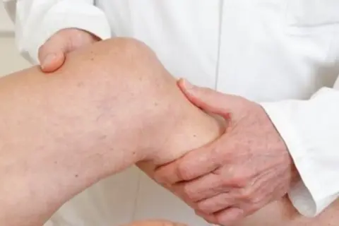 Arzt untersucht Knie. Mögliche Symptome für ein Ewing-Sarkom werden abgetastet.