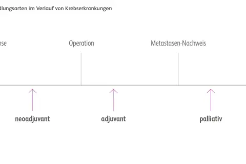 Zeitstrahl zeigt Behandlungsphasen bei Krebs: Diagnose, Operation, Metastasennachweis. Pfeile markieren neoadjuvante, adjuvante und palliative Therapie.