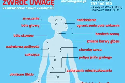 Akromegalia: zmęczenie, bóle głowy, stawów, nadciśnienie, problemy ze wzrokiem, bezdech senny, cukrzyca. Zwróć uwagę na te objawy!