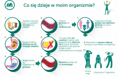 Ilustracja przedstawia schemat działania organizmu przy cukrzycy typu 2, od spożycia węglowodanów do objawów.
