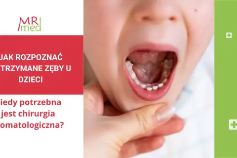 Dziecko z otwartymi ustami, widoczne nieprawidłowe wyrzynanie się zębów stałych. Tekst informuje o zatrzymanych zębach u dzieci i chirurgii stomatologicznej.
