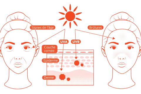 Illustration montrant les effets des rayons UVA et UVB sur la peau : vieillissement prématuré et coups de soleil.