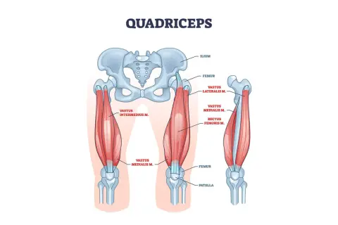 Illustrazione anatomica del quadricipite femorale, mostrando il femore, l'ilio e la rotula, con i muscoli vasto laterale, mediale, intermedio e retto del femore.