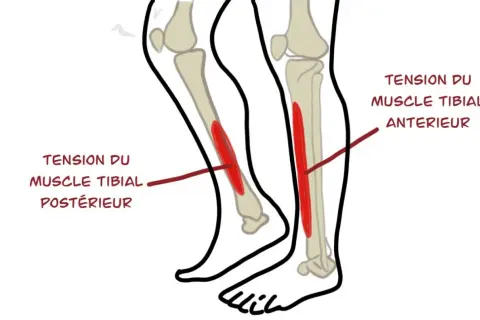 Schéma des muscles du tibia, montrant la tension du muscle tibial antérieur et postérieur, cause fréquente de mal au tibia.