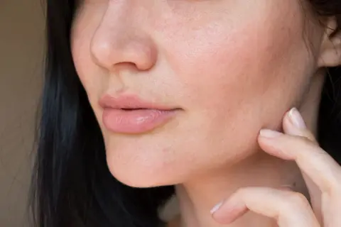 Nahaufnahme eines Gesichts mit vollen Lippen und leicht trockenen Wangen, die von einer Hand berührt werden.