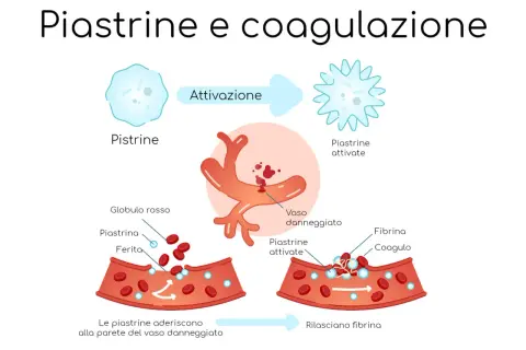Illustrazione del processo di coagulazione del sangue: le piastrine, quando i piastrine valori normali sono compromessi, si attivano e formano un coagulo.