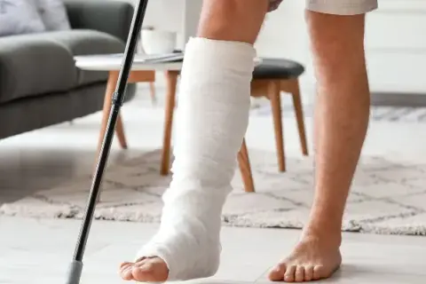 Rehabilitacja nogi po gipsie: Twój przewodnik krok po kroku