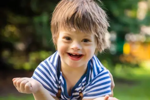Un bambino sorridente con la sindrome di Down, con i suoi tratti distintivi, indossa una maglietta a righe blu e bianche.