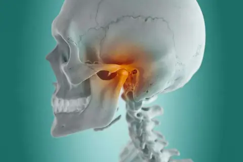 Dettaglio anatomico del cranio e delle vertebre cervicali, con enfasi sull'articolazione temporo-mandibolare (ATM) evidenziata in arancione, suggerendo i sintomi di un disturbo.