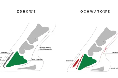 Zdrowe kopyto vs. ochwatowe: rotacja kości kopytowej i naciągnięte ścięgno przy zapaleniu kopyta konia.