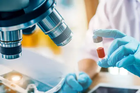 Forscher untersuchen Blutproben für die Immuntherapie bei Lungenkrebs. Ein Mikroskop und eine Ampulle mit roter Flüssigkeit sind zu sehen.