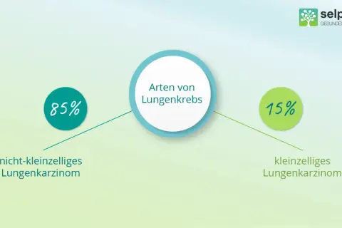 Grafik zeigt Lungenkrebsarten: 85% nicht-kleinzelliges Lungenkarzinom, 15% kleinzelliges Lungenkarzinom.