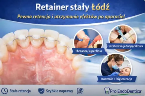 Retainer stały to pewna retencja zębów po leczeniu ortodontycznym. Pokazano higienę z użyciem nici dentystycznej i szczoteczki jednopęczkowej.