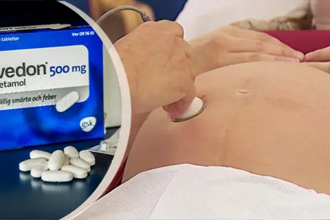 Alvedon 500 mg paracetamol för tillfällig smärta och feber. Graviditet kan innebära oro, men vissa läkemedel kan vara säkra.