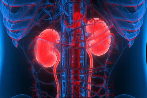 Anatomia nerek z widocznymi naczyniami krwionośnymi. Obraz może sugerować problemy z krążeniem lub zwapnienie nerek.