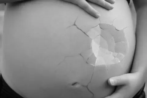 En gravid mage med sprickor som ett äggskal, symboliserar ett tidigt missfall och den bräcklighet som kan följa.