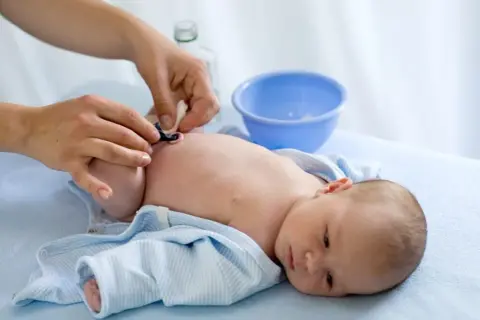 Jak dbać o kikut pępowiny? Objawy infekcji i pielęgnacja