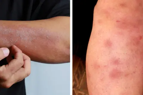 Zaburzona flora jelit: objawy, które zaskakują. Kiedy do lekarza?