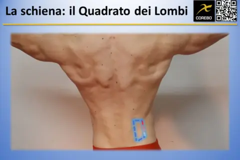 Vista posteriore di un uomo con evidenziate le fasce muscolari schiena, in particolare il quadrato dei lombi.