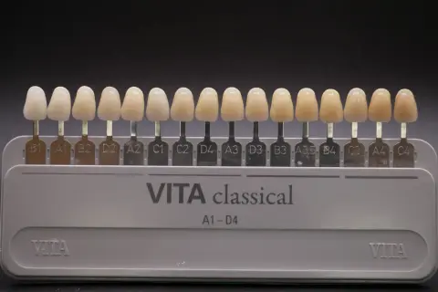 Scala VITA classical per la scelta del colore dei denti. Denti finti di varie tonalità per trovare la perfetta scala vita denti.