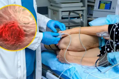 Zbliżenie na komórki raka jelita grubego obok pacjenta podłączonego do aparatury medycznej.