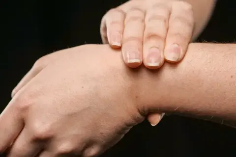 Dłoń z widocznym, twardym guzem na wewnętrznej stronie nadgarstka. Palce drugiej dłoni delikatnie dotykają tego miejsca.