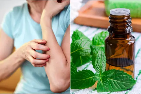 Persona se rasca el brazo por picores en la piel. Al lado, un frasco de aceite esencial de menta y hojas frescas.