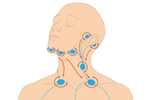 Illustration zeigt Lymphknoten im Halsbereich mit Pfeilen, die den Lymphfluss darstellen. Die Lymphknoten haben eine normale Größe.