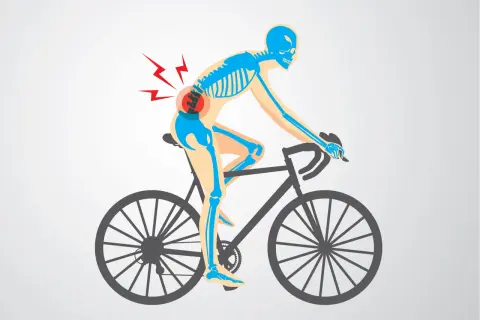 Skelett auf einem Fahrrad mit Schmerzsymbolen im unteren Rückenbereich, das auf Probleme mit der Fahrradergonomie hinweist.