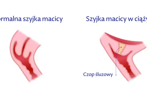 Czy krótka szyjka macicy ułatwia poród? Fakty, zagrożenia i porady dla kobiet w ciąży
